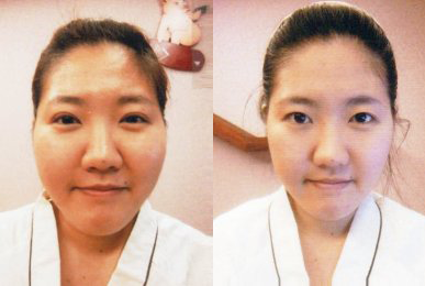 Chun Min-ji (Intensive Cheek)