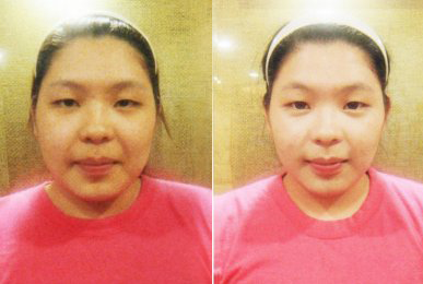 Kim Jeong-a (Intensive Cheek)
