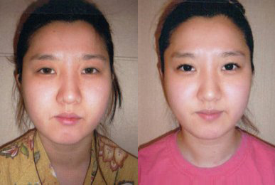 Kyung-eun Kim (Concentrated cheekbone care)