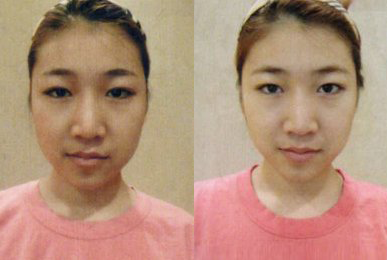 Ji-eun Lee