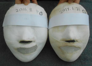 [Balanced Face]Gangnam station Before&After/ 20sessions