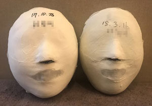 [Balanced Face]Gwangju Suwan Before&After /20sessions