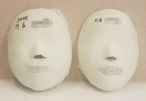 [Balanced Face]Sadang Before&After/ 20sessions