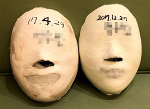 [Small Face]Wonju Before&After /20sessions