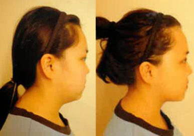 [Double Chin Care] Eun-Jin Hong, Wonju branch