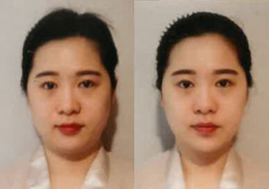 [Baby Face Care] Yae-Seul Yu, Dongdaemun branch