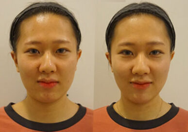 [Baby Face Care] Choi Da-Jeong (Sanbon Branch)