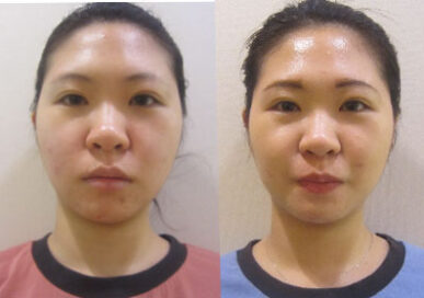 [Baby Face Care] Jeon Bo-Yeon (Seolleung Branch)