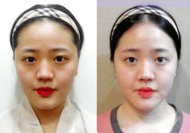 [Baby Face Care] Kim Hyeon-Ji (Hwamyeong Branch)