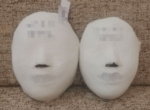 [Small Face Care]  Dongtan Naru Before and After 20 sessions