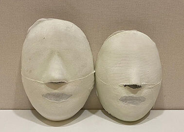 [Baby Face Care] Sanbon branch Before and After 20 Sessions