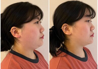[Double Chin Care] Ko Eui-Jeong (Cheongnyangni)