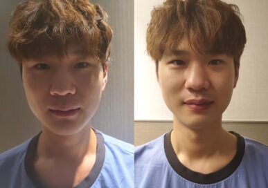 [Small Face Care] Kim Won-Cheol (Hanti)