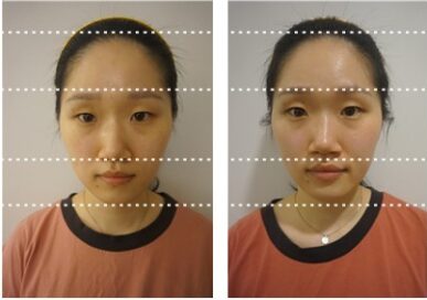 [Face Sculpting Care] Cha Eun-Ju (Cheonho)