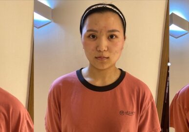 [Baby Face Care] Woo Yang-Ji (Gwangju Suwandong)