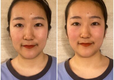 [Baby Face Care] Moon Ji-Hye (Cheongnyangni)