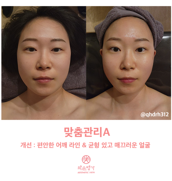 [약손명가 후기] 일산점에서 맞춤관리A 받아 본 솔직 후기