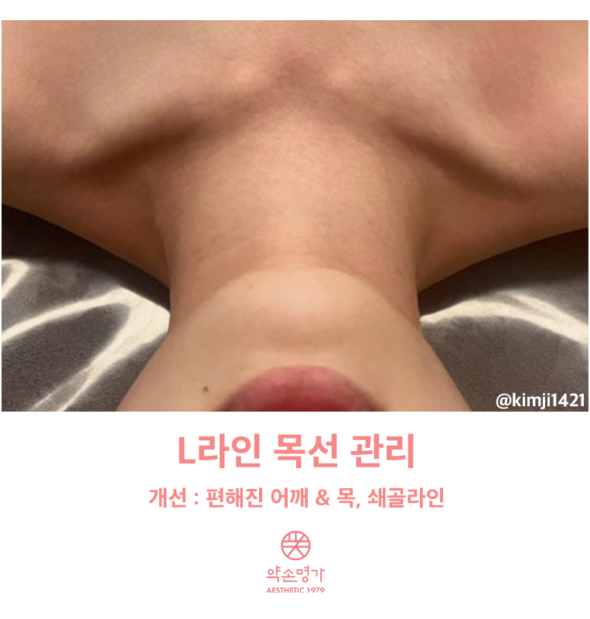 청주윤곽 바디관리 약손명가청주용암동점